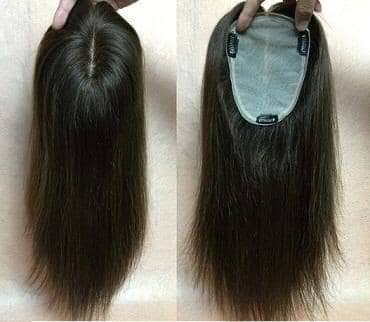 Customize Ladies Hair Patch Delhi Ramesh Nagar New Delhi India